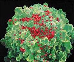 HIV