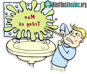 Mụn - nỗi khổ không chỉ riêng phụ nữ