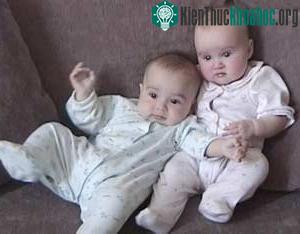Dùng nhiều axit folic dễ sinh đôi khi thụ tinh ống nghiệm ảnh 0