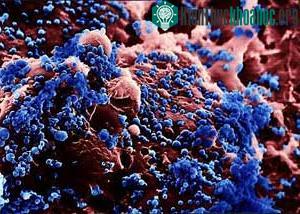 H5N1 (Ảnh: baggas)