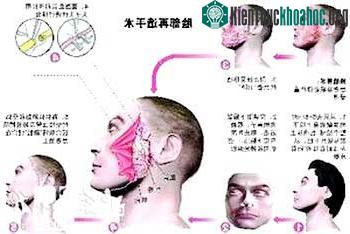 Kinh nghiệm cấy ghép mặt từ Trung Quốc ảnh 0
