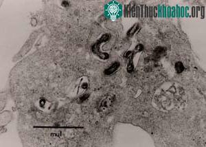 Khuẩn Leptospira