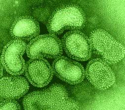 Virus gây cúm ở Tây Ban Nha năm 1918