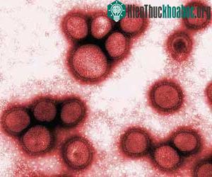 Virus H1N1