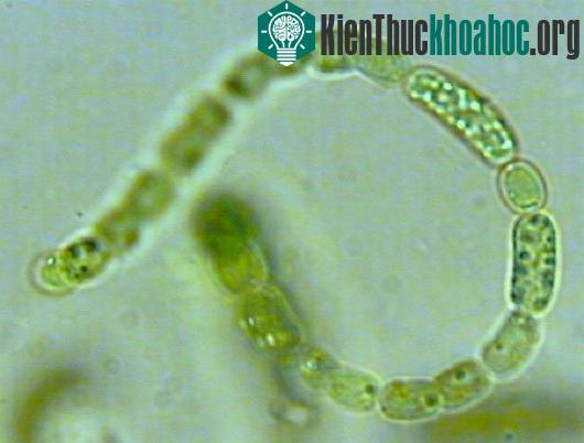 Rất nhiều vi khuẩn gây bệnh tồn tại trong nước bị ô nhiễm