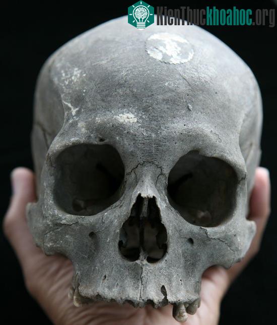 Xương sọ người