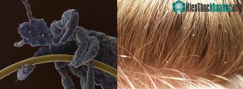 14. Cận cảnh hình ảnh con chấy bám chặt trên sợi tóc, trống nó như một con quái vật khi được phóng to lên.