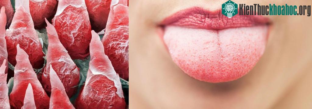 4. Đây chính là hình ảnh lưỡi của chúng ta khi được phóng to.