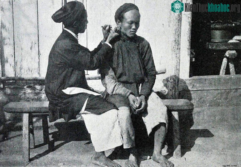 Nghề lấy ráy tai dạo.