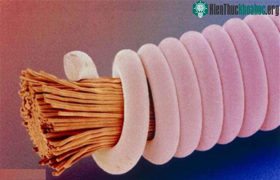 Hình ảnh chân thực của dây đàn ghi ta dưới kính hiển vi