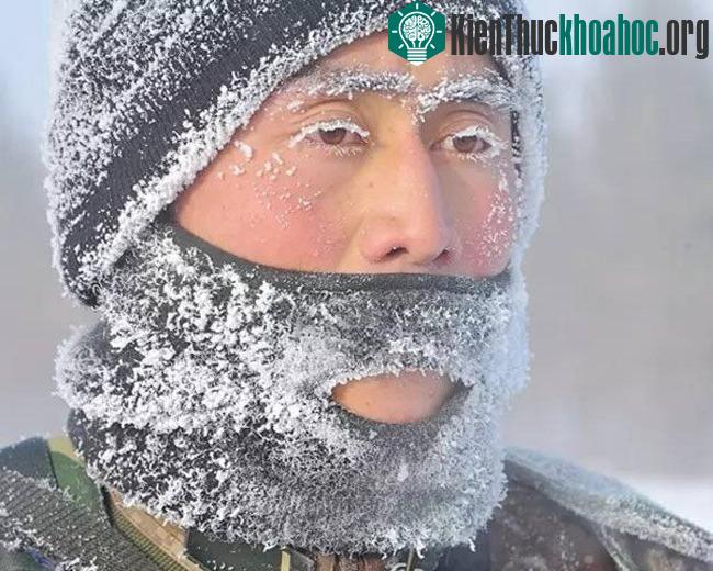 Băng tuyết trắng xóa trên áo, mũ len, lông mày và lông mi một người lính khi phải đứng lâu ngoài trời.