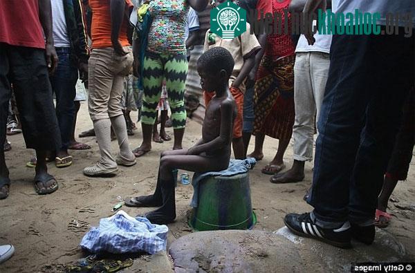 Cậu bé Saah Exco, 10 tuổi, đang sống trong một con hẻm phía sau khu ổ chuột West Point tại thành phố Monrovia, Liberia. Ngày 19/8, cậu bé bị từ chối c...