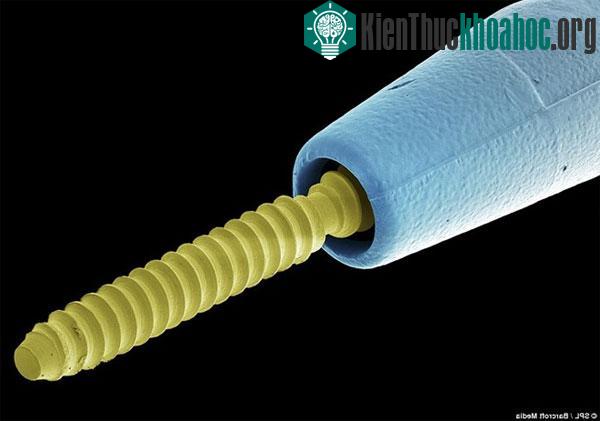 Mũi khoan của bác sĩ nha khoa. Nó được phóng đại 28 lần.