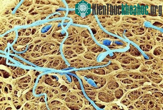 Tinh trùng trên bề mặt của một quả trứng người. Đây là hình ảnh phóng đại của một số tinh trùng đang tìm cách thụ tinh cho trứng