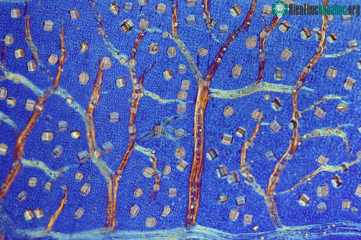Lá của cây phỉ đen (Trichocladus crinitus) đang sản sinh ra các tinh thể để chống lại các loại động vật tới ăn (độ phóng đại 100 lần)
