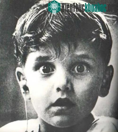 Đôi mắt bừng tỉnh - Harold Whittles bẩm sinh đã bị điếc, và đây là khoảnh khắc khi em lần đầu tiên được nghe thấy âm thanh cuộc sống từ thiết bị trợ thính.