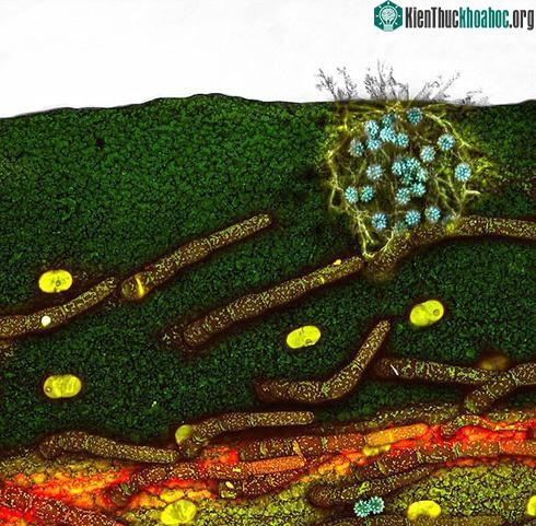 Hình ảnh hiển vi của một cánh hoa cúc bị nhiễm nấm và phấn hoa của tiến sĩ Joseph Rigby từ Đại học Tây Úc - (Ảnh: Daily Mail)