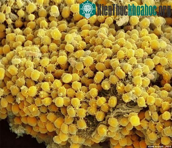Vi khuẩn màu vàng, bám trên răng, lợi và những vùng khác trong miệng của con người.
