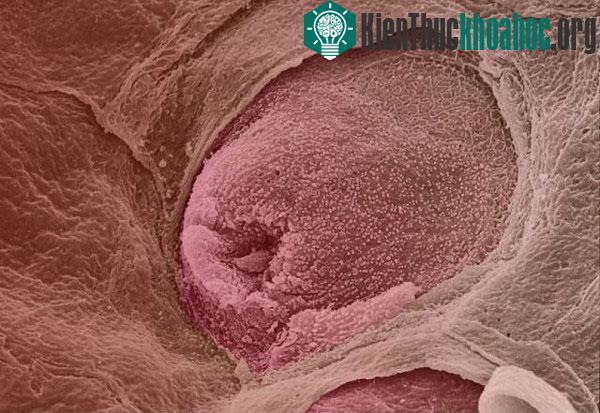 Các chồi vị giác ở lưỡi (còn gọi là nụ vị giác). Trên bề mặt lưỡi người có khoảng 10.000 nụ vị giác chịu trách nhiệm phát hiện các tín hiệu về vị khác nhau như mặn, cay, đắng, ngọt và ngon