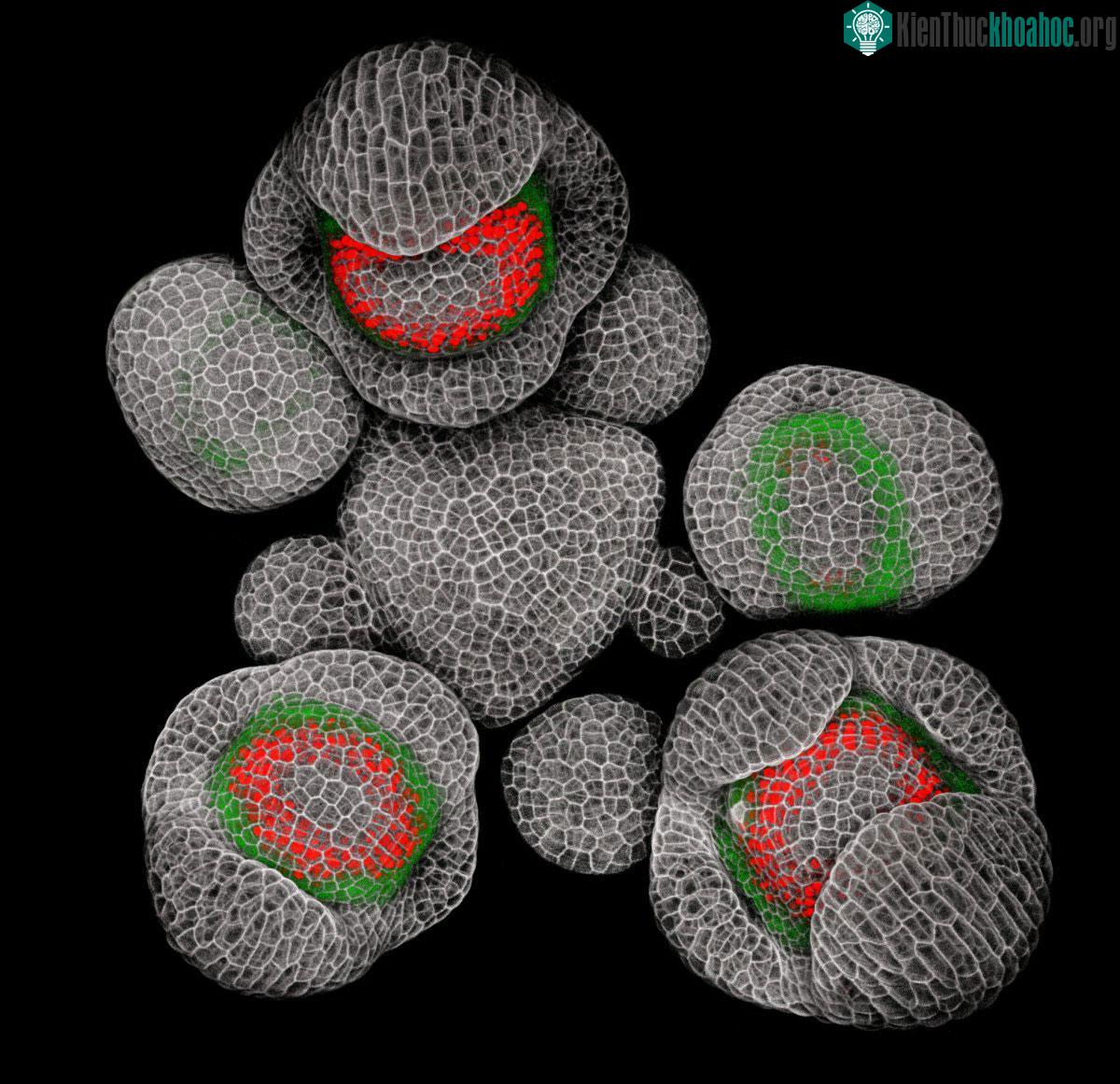 Chồi nụ của loài thực vật Arabidopsis (độ phóng đại 40 lần)