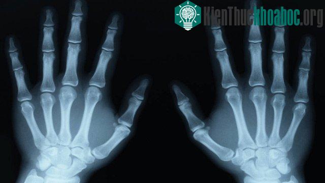 Những phát minh tình cờ đến khó tin nhưng vĩ đại