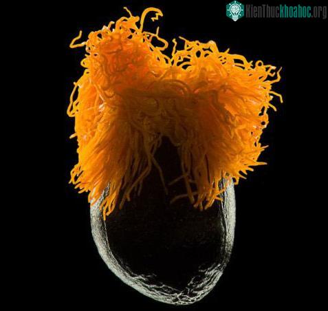 Những bức ảnh thế giới vi mô đẹp nhất năm 2010 ảnh 4