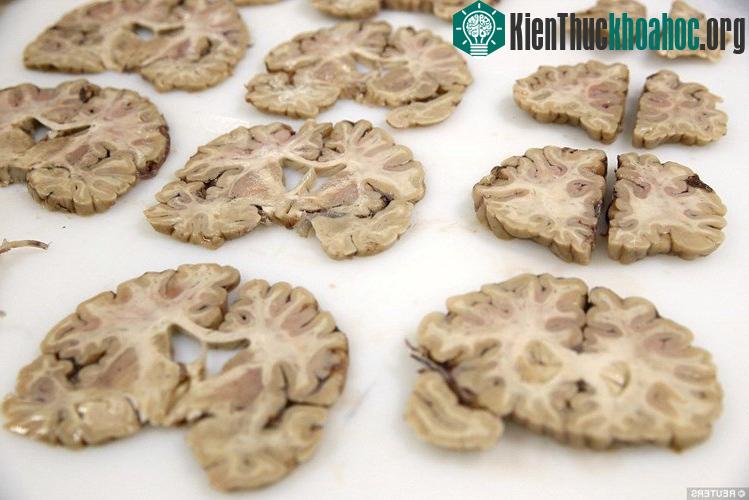 Với phần não đông lạnh, các nhà nghiên cứu sẽ tiến hành cắt hoặc thát lát chúng thành những phần nhỏ, sau đó chúng sẽ được chụp ảnh trước khi cho vào lưu trữ trong tủ đông lớn.