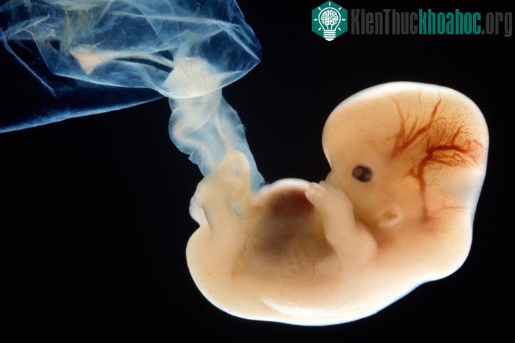 Nhân bản con người hiện còn là một vấn đề gây tranh cãi.