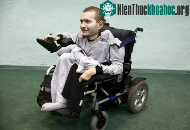 Sergio Canavero tin rằng cuộc phẫu thuật này sẽ là phép màu kỳ diệu của khoa học.
