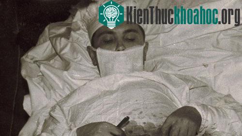 Rogozov tự phẫu thuật cắt bỏ ruột thừa. Ảnh: BBC