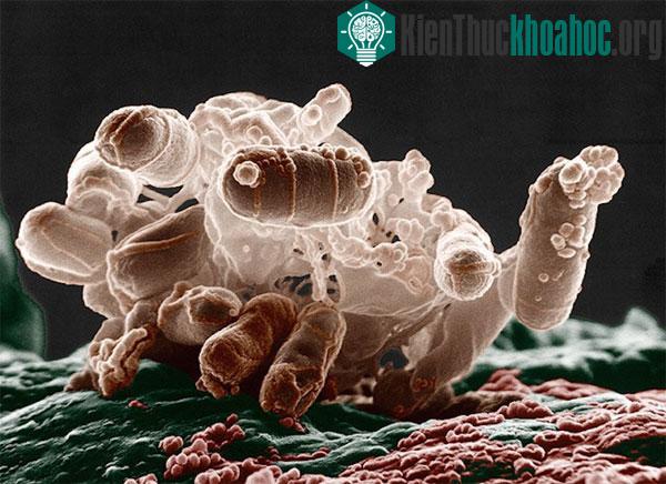 Hình ảnh phóng đại của vi khuẩn E. coli​