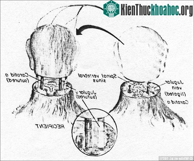Ghi chép của tiến sĩ Robert White với ca phẫu thuật ghép đầu trên loài khỉ vào năm 1970.