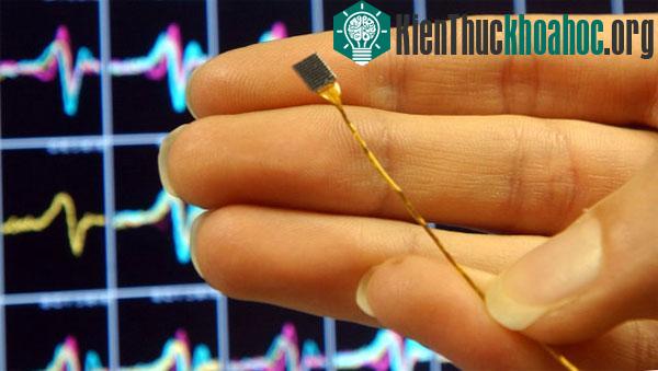 Thiết bị cấy ghép vào não để điều trị chứng chấn thương tâm lý sau bị thương​