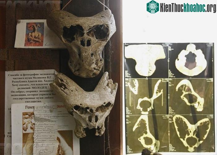 Các nhà thám hiểm Nga phát hiện 2 chiếc đầu lâu hình thù kỳ dị trên dãy núi Caucasus. Nhiều người nghi ngờ đó là hộp sọ của người ngoài hành tinh. Xem thêm tại đây