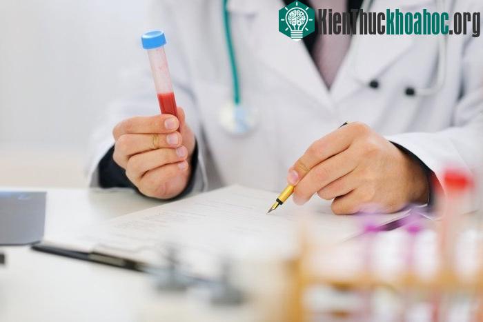 Cách đọc kết quả xét nghiệm máu hay nước tiểu là điều bạn cần khi đi khám sức khỏe vì các bác sĩ vẫn hay chỉ định bệnh nhân đi làm xét nghiệm máu và xét nghiệm nước tiểu. Tuy nhiên nếu bác sĩ không...