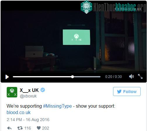 Chữ B, O trong Xbox One cũng không tạm thời bị xóa.