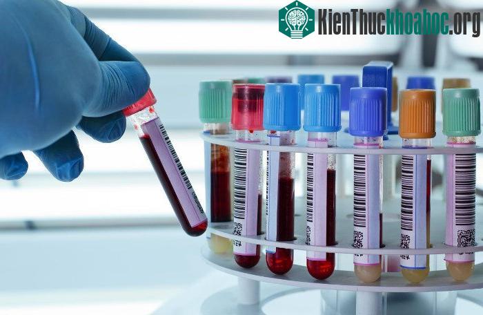 Các nhà thiên văn tại Đài thiên văn của Học viện Khoa học Nga đã chính thức kết luận, rằng tín hiệu mà RATAN-600 dò được là gần như chắc chắn đến từ Trái Đất, rất có thể phát ra từ một hoạt động qu...
