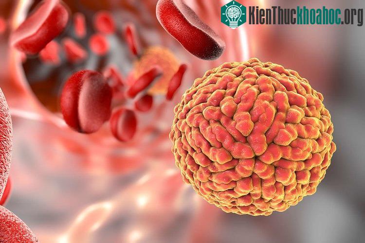 Virus Zika là thủ phạm gây ra dị tật đầu nhỏ cho nhiều trẻ em. (Ảnh: Kateryna Kon/Science Photo Library).