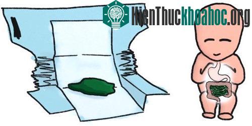 Phân su đi ra khỏi cơ thể thai nhi lần đầu tiên sau khi chào đời. (ảnh minh họa).