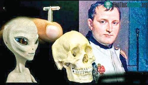 Con chip tìm thấy trong hộp sọ Napoleon.