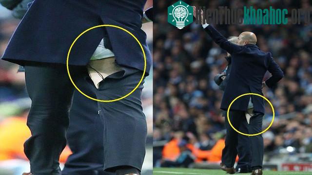 Zinedine Zidane bị toạc đũng quần trong một trận đấu giao hữu giữa Real Madrid và Manchester City.