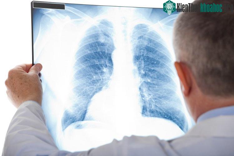 Tầm soát ung thư nhằm phát hiện ra mầm mống ung thư, hoặc khi khối u còn rất nhỏ, trước khi triệu chứng xuất hiện.