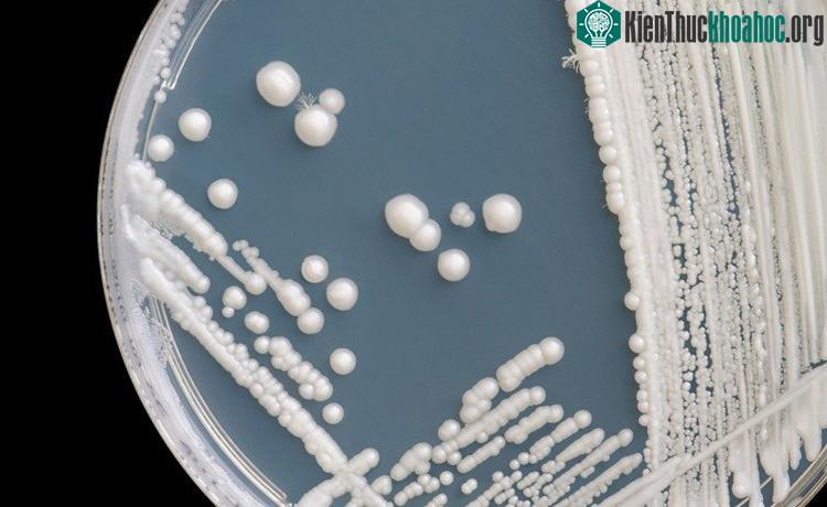 Candida auris, một chủng nấm gây nhiễm trùng chết người mới.