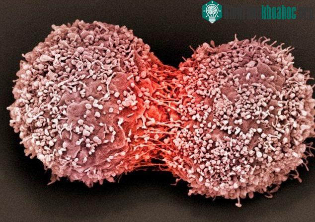 Mỗi người đều có các tế bào ung thư trong cơ thể.