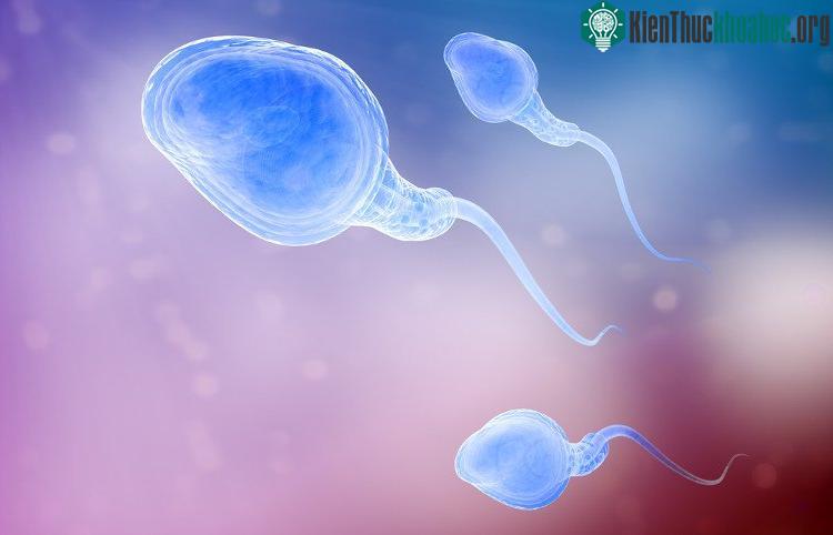 Có một vài lý do khiến nam giới bị vô sinh, trong đó nguyên nhân về di truyền là đáng ngại nhất.