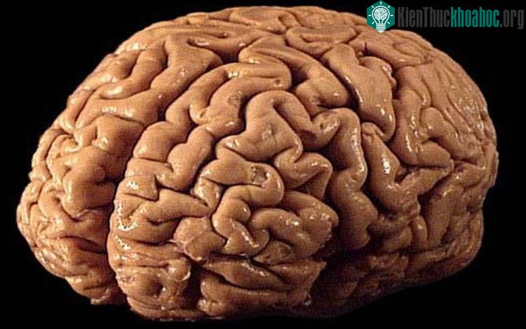 Ô nhiễm không khí khiến lượng "chất trắng" trong não có nguy cơ bị teo đi.