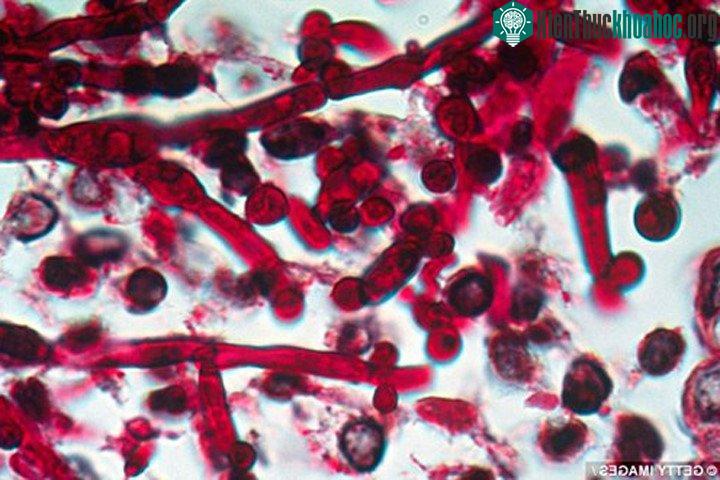 Được gọi là Candida auris, chủng nấm này kháng thuốc rất mạnh và có khả năng gây ra nhiễm trùng máu dẫn đến tử vong.