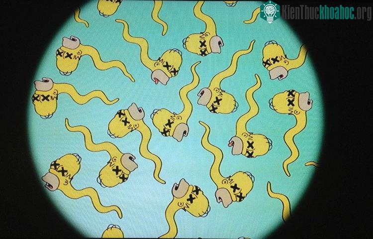 Nếu tinh dịch đồ có bất thường, nên thực hiện ít nhất 2 - 3 lần để đánh giá, kiểm tra và so sánh.