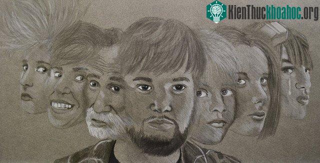 Triệu chứng bệnh cũng khác nhau trên những bệnh nhân khác nhau.