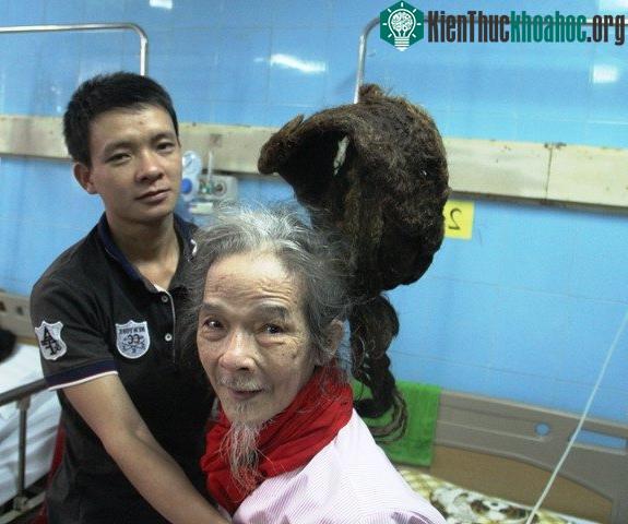 Dù sức khỏe yếu nhưng cụ ông vẫn nhất quyết không chịu cắt tóc. (Ảnh: T.H).